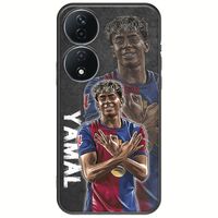 Football Stars - Lamine Yamal Honor 90 Smart 5G Black TPU (Μαύρη Σιλικόνη)